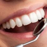 Sonrisa óptima
